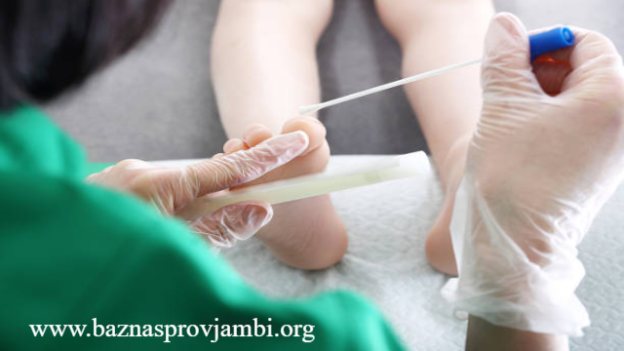 Cara Mengatasi Kuku Berjamur serta Ketahui Penyebabnya